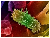 <p>JSM Meat Holdings Company, Inc.-a Chicago-based meat company, is voluntarily recalling beef products distributed in 11 states because of possible E. coli contamination, federal officials announced. The beef products being recalled were intended for use in ground products.</p>

