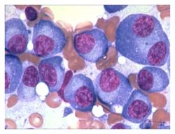 Boston -- U.S. medical scientists say they've determined a drug used to treat multiple myeloma also shows promise in immune system therapy.